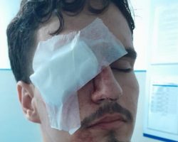 Governo do Rio busca entendimento com jovem ferido por bala de borracha durante clássico no Maracanã